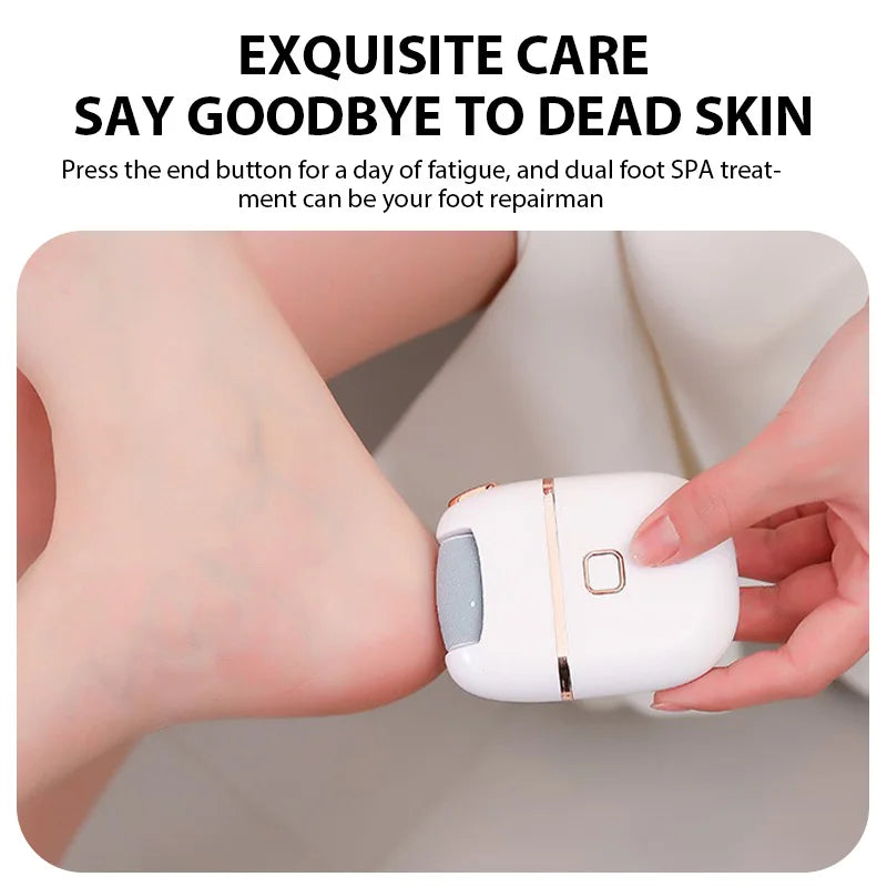 Rechargeable Electric Foot Grinder – Callus Remover & Heel Smoother