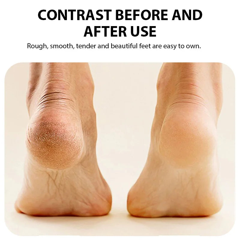 Rechargeable Electric Foot Grinder – Callus Remover & Heel Smoother